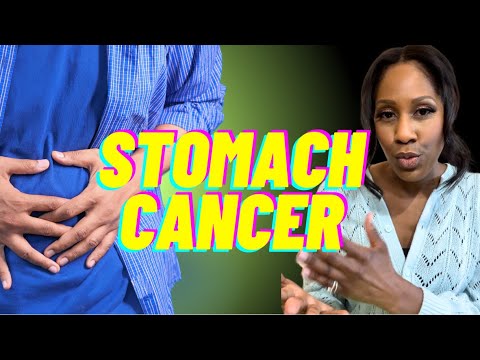 Stomach Cancer: What Are the Symptoms and What Causes it? A Doctor Explains