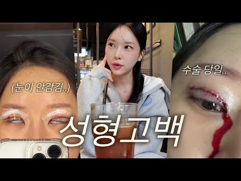 이 수술은 제발 절대 하지마세요..❌쌍커풀 재수술만 4번 한 이유, 부작용? 제 모든 성형 썰 솔직후기