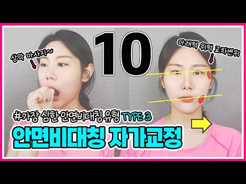 안면비대칭 Type3 교정운동 / 안면비대칭 자가교정 /  안면비대칭 교정운동  [교정의 신, 리샘TV]