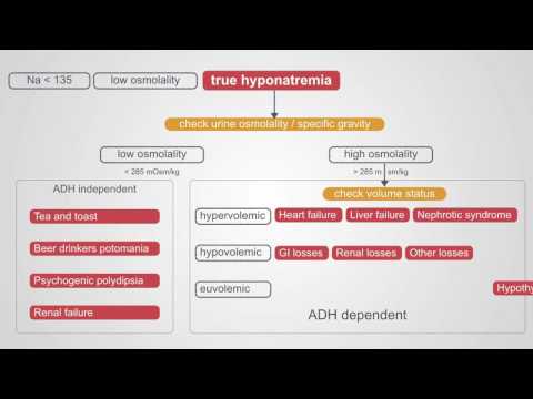 Diagnosing Hyponatremia: A Comprehensive Algorithm