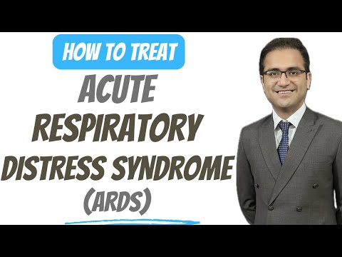 Acute Respirtory Distress Syndrome (ARDS) Treatment, Pathophysiology, Medicine Lecture USMLE NeetPg