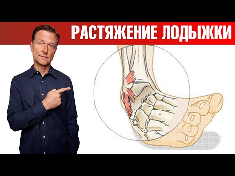 Повреждение лодыжки: что делать при растяжении лодыжки😲