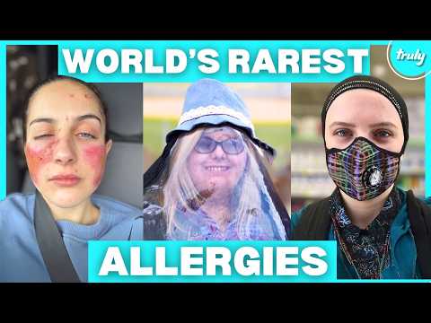 The World's Rarest Allergies | BORN DIFFERENT