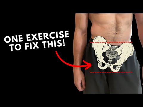 Fix Lateral Pelvic Tilt In ONE Exercise!
