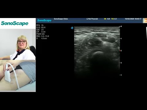 Мастер-класс на аппарате SonoScape S8Exp. Лектор: Заболотская Н.В.