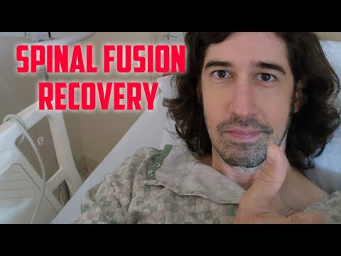 L5 S1 Spinal Fusion Surgery - What to Expect