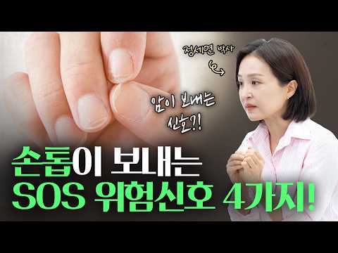 여러분, 손톱에 이런 증상 나타나면 암이 오는 신호입니다 | 정세연의 라이프연구소