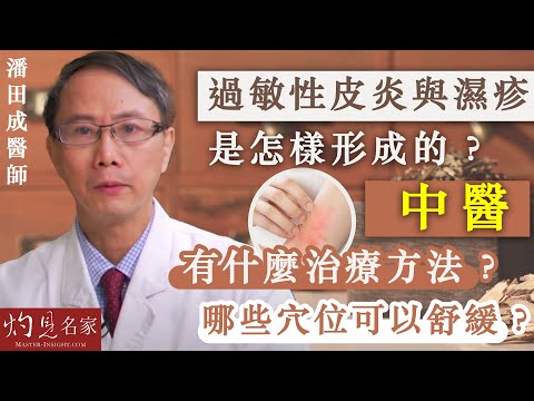 【字幕】潘田成醫師：過敏性皮炎與濕疹是怎樣形成的？ 中醫有什麼治療方法？ 哪些穴位可以舒緩？《浸大中醫在線》（2023-06-04）（影片由香港浸會大學中醫藥學院臨床部提供）