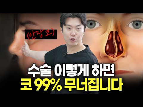 코수술 후 코 무너지는 사람 특징 (feat. 안장코)