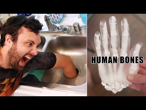 What Happens if You Put Your Hand in a Garbage Disposal?