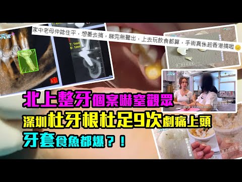 北上整牙個案嚇窒觀眾｜深圳杜牙根杜足9次劇痛上頭　牙套食魚都爆？！