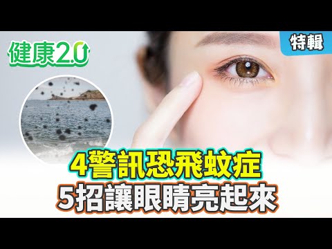 【特輯】4警訊恐飛蚊症 沒注意當心變視網膜剝離！5招護眼睛 助氣血循環 瞬間明亮！｜健康2.0 #鄭凱云 #陳欣湄 #韋汝