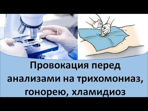 Провокация перед анализами на трихомонады, гонорею и хламидиоз
