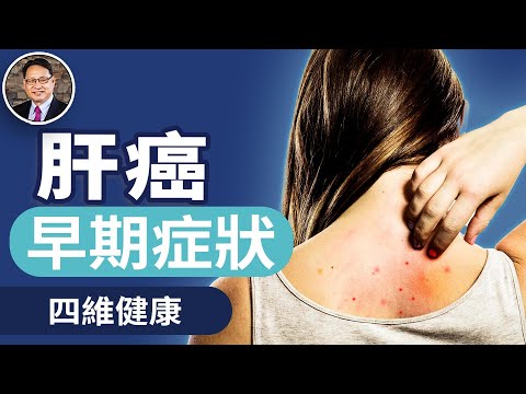 皮膚異常竟是肝癌警訊？這四種症狀千萬別輕忽！