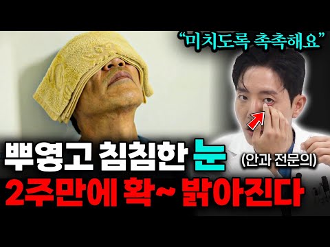 "돈 쓰지 말고 3분만 하세요" 아프고 뻑뻑한 눈 번쩍 밝아집니다! (조성원 원장님 2부)