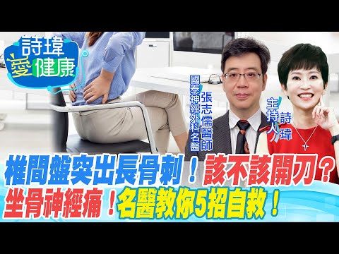 【#詩瑋愛健康】坐骨神經痛！椎間盤突出、長骨刺，該不該開刀？名醫教你5招自救！賴清德急性下背痛，脊椎微創手術1天就出院，要保養！免得打噴嚏就復發？張志儒醫師20220810@中天電視CtiTv @健康我加1CtiHealthyme