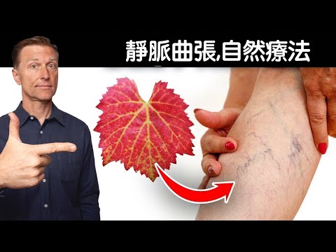 靜脈曲張,第1名的自然療法,柏格醫生 Dr Berg