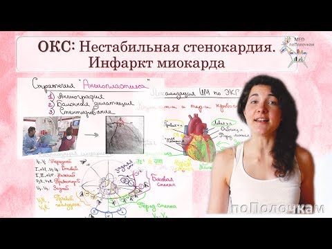 Acute coronary syndrome (ACS): Infarction and unstable angina