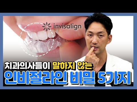 치과의사들이 말하지 않는 인비절라인 비밀 5가지