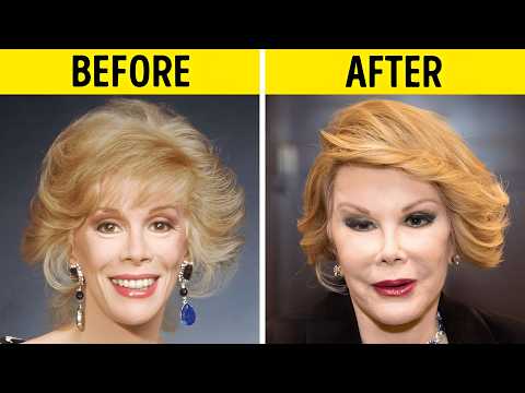 75+ Celebrity Plastic Surgery Disasters | Before and After