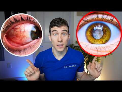 7 Eye Diseases That Can Steal Your Vision — And How to Stop Them