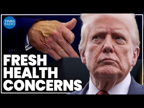 Trump’s ‘highly unusual’ interview fuels fresh health concerns