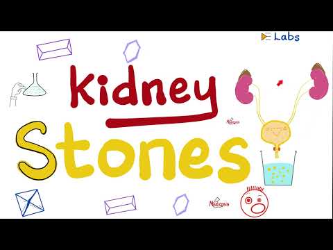 Urine Crystals & Kidney Stones - Nephrolithiasis - Urinary Tract Stones and Sediments - Urology