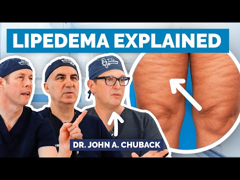 Lipedema vs Obesity: The Hidden Fat Disorder Doctors Miss