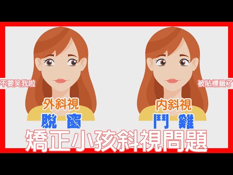 斜視是什麼？脫窗、鬥雞眼都是斜視的問題 【諾貝爾眼科帶你一解斜視的成因】