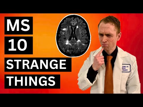 10 Strange Things About Multiple Sclerosis