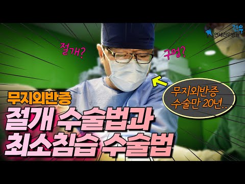 무지외반증 어떤 수술 방법이 좋을까??
