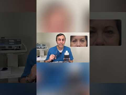 Don't Make This Wrinkle Surgery Mistake! Sock Analogy Revealed #shorts