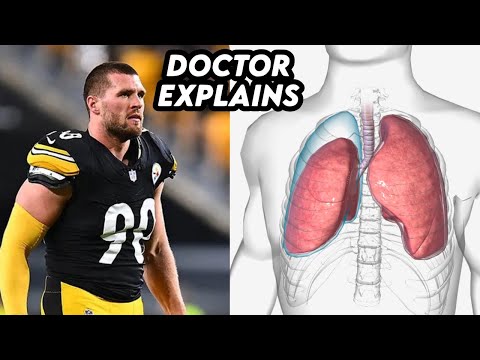 TJ Watt Lung Collapses From Rehab Treatment Complication - Doctor Explains