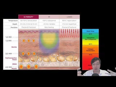 科學新知 2025-01-09 Part3: 逆齡減紋提升皮膚，Thermage/Ultherapy/HIFU背後的科學根據。| 主持： 陳志宏 博士 & 台長 梁錦祥