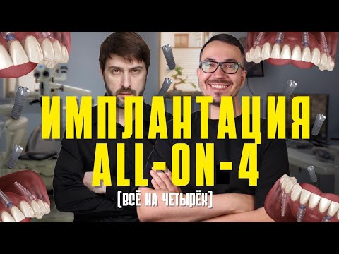 ИМПЛАНТАЦИЯ ЗУБОВ All-ON-4 | Всё на четырёх