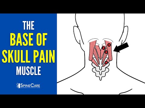 The Base of the Skull Pain Muscle (How to Release It for INSTANT RELIEF)