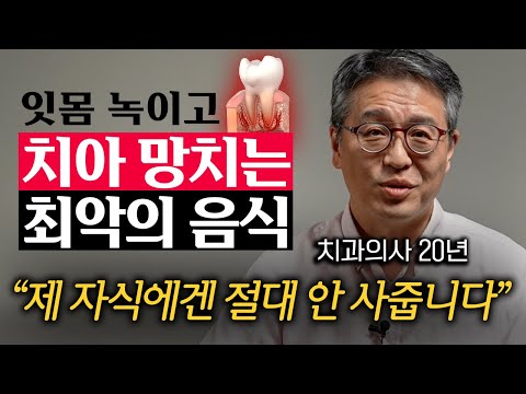 치아에 구멍 생기기 싫다면 이 '3가지' 음식은 당장 끊으세요. (박창진 원장 1부)