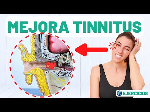 10 ejercicios para aliviar el tinnitus -acúfenos