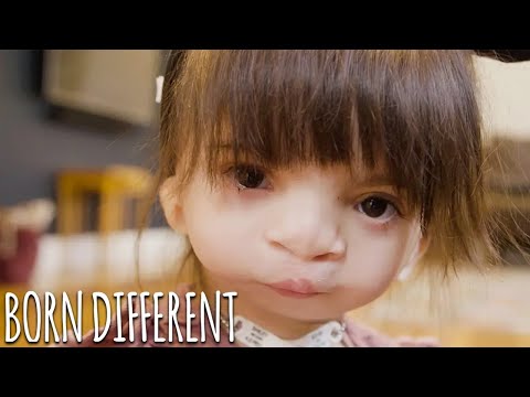 Doctors Can't Explain Our Rare Conditions | BORN DIFFERENT