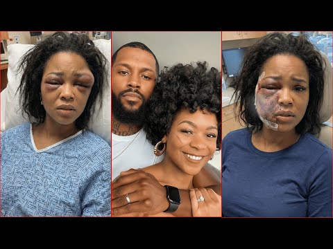 She Became His P@nch Bag, It led to 3 MISCARRIAGE & Her Womb Was Removed-He Divorced Her To Marry BF