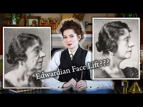 The Edwardians had Cosmetic Surgery & it Wasn't Dissimilar to Today
