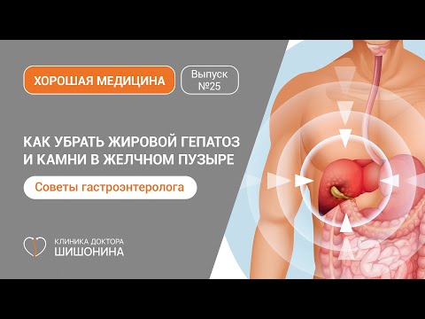 Как убрать жировой гепатоз и камни в желчном пузыре - рассказывает лучший гастроэнтеролог Москвы 🩺❤️