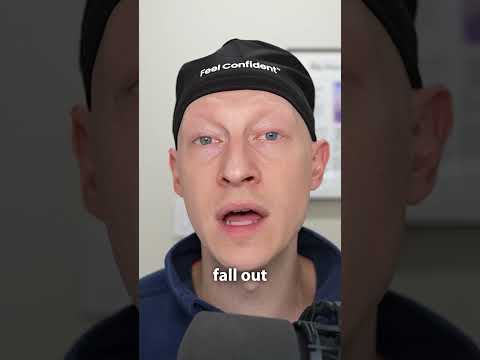 Does Testosterone Replacement Therapy Cause Hair Loss?