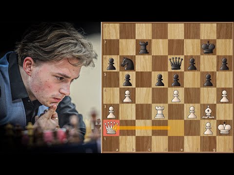 Difference Between GM and Top 10 GM