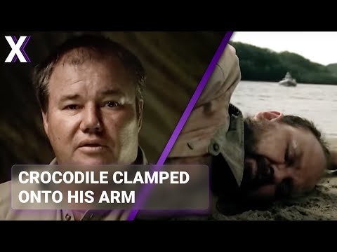 Crocodile Attack Survivor’s Harrowing Escape