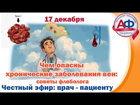 What are the dangers of chronic vein disease? Advice from a phlebologist