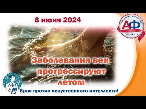 Заболевания вен прогрессируют летом?