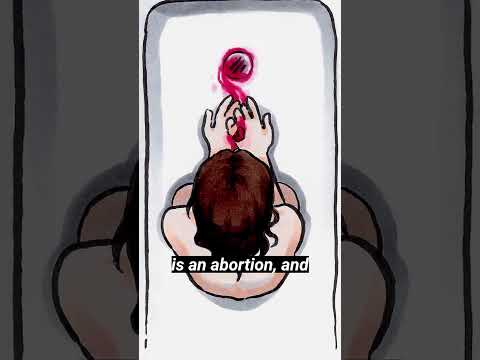 Leslie Shares Her Painful #ISawMyBaby Abortion Pill Experience.