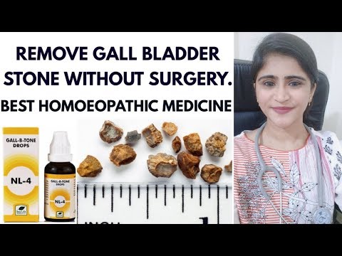 Gall bladder stone||Homoeopathic medicine for gall bladder stone||Remove stone without surgery||
