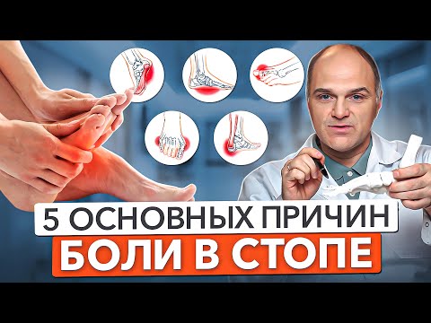 5 ОСНОВНЫХ ПРИЧИН БОЛЕЙ В НОГАХ. Почему болят стопы?